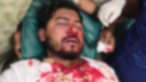 বিজয়নগরে জাতীয় পার্টি-গণঅধিকার সংঘর্ষে নুরুল হক নুর গুরুতর আহত