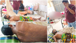 সিরাজগঞ্জে ডিবি হেফাজতে আসামির মৃত্যু, পুলিশের দাবি ‘শ্বাসকষ্ট’