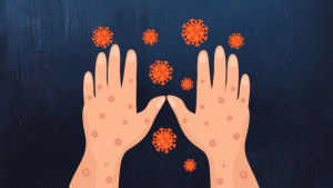 হামে আরও ১০ জনের মৃত্যু, আক্রান্ত ১২৪৮