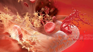 হিমোফিলিয়া: নীরব কিন্তু গুরুতর রক্তক্ষরণজনিত রোগ