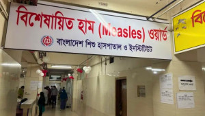 হাম বাড়ছেই, শিশু হাসপাতালে মূল সংকট আইসিইউ বেড