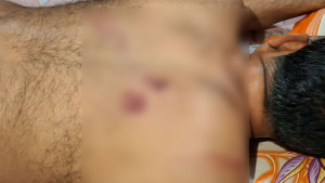 স্বর্ণব্যবসায়ীকে ডেকে নিয়ে বিএনপি নেতার মারধর