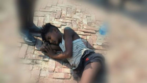 আরাকান আর্মির স্থলমাইন বিস্ফোরণে রোহিঙ্গা কিশোরের পা বিচ্ছিন্ন