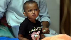 দেশের হাসপাতালে আইসিইউ ও ভেন্টিলেশন সেবা কতটা আছে, কী পরিস্থিতি?